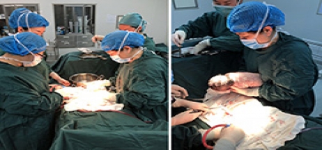 當(dāng)高危產(chǎn)婦碰上“熊貓血”如何抉擇？