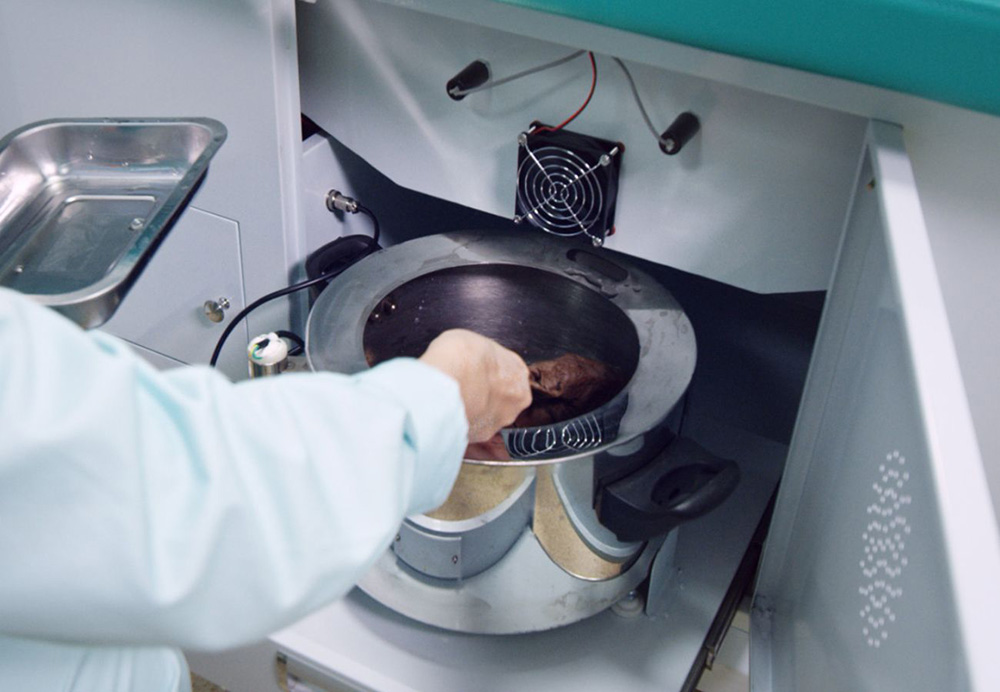 康復治療70天，偏癱患者步行出院！(圖2)