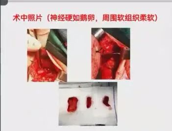 聚焦顯微外科|葫蘆島市醫(yī)學(xué)會(huì)顯微外科學(xué)分會(huì)第一屆第二次學(xué)術(shù)會(huì)議順利召開(圖5) 聚焦顯微外科|葫蘆島市醫(yī)學(xué)會(huì)顯微外科學(xué)分會(huì)第一屆第二次學(xué)術(shù)會(huì)議順利召開(圖5)