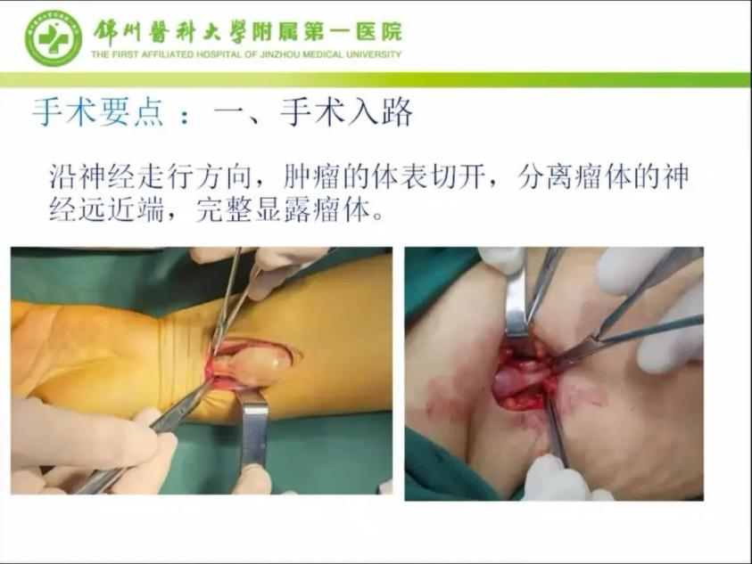 聚焦顯微外科|葫蘆島市醫(yī)學(xué)會(huì)顯微外科學(xué)分會(huì)第一屆第二次學(xué)術(shù)會(huì)議順利召開(圖13) 聚焦顯微外科|葫蘆島市醫(yī)學(xué)會(huì)顯微外科學(xué)分會(huì)第一屆第二次學(xué)術(shù)會(huì)議順利召開(圖13)